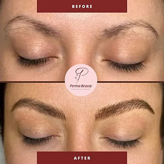 Simple Photocentric Before and After Instagram Post - 1